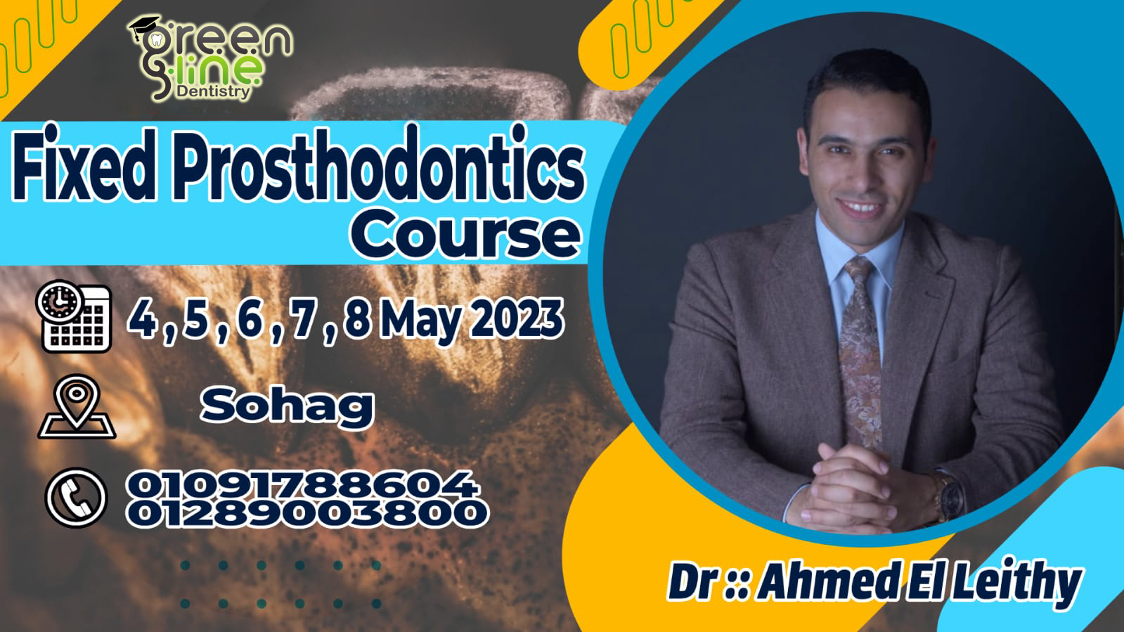 Fixed Prosthodontics From A TO Z